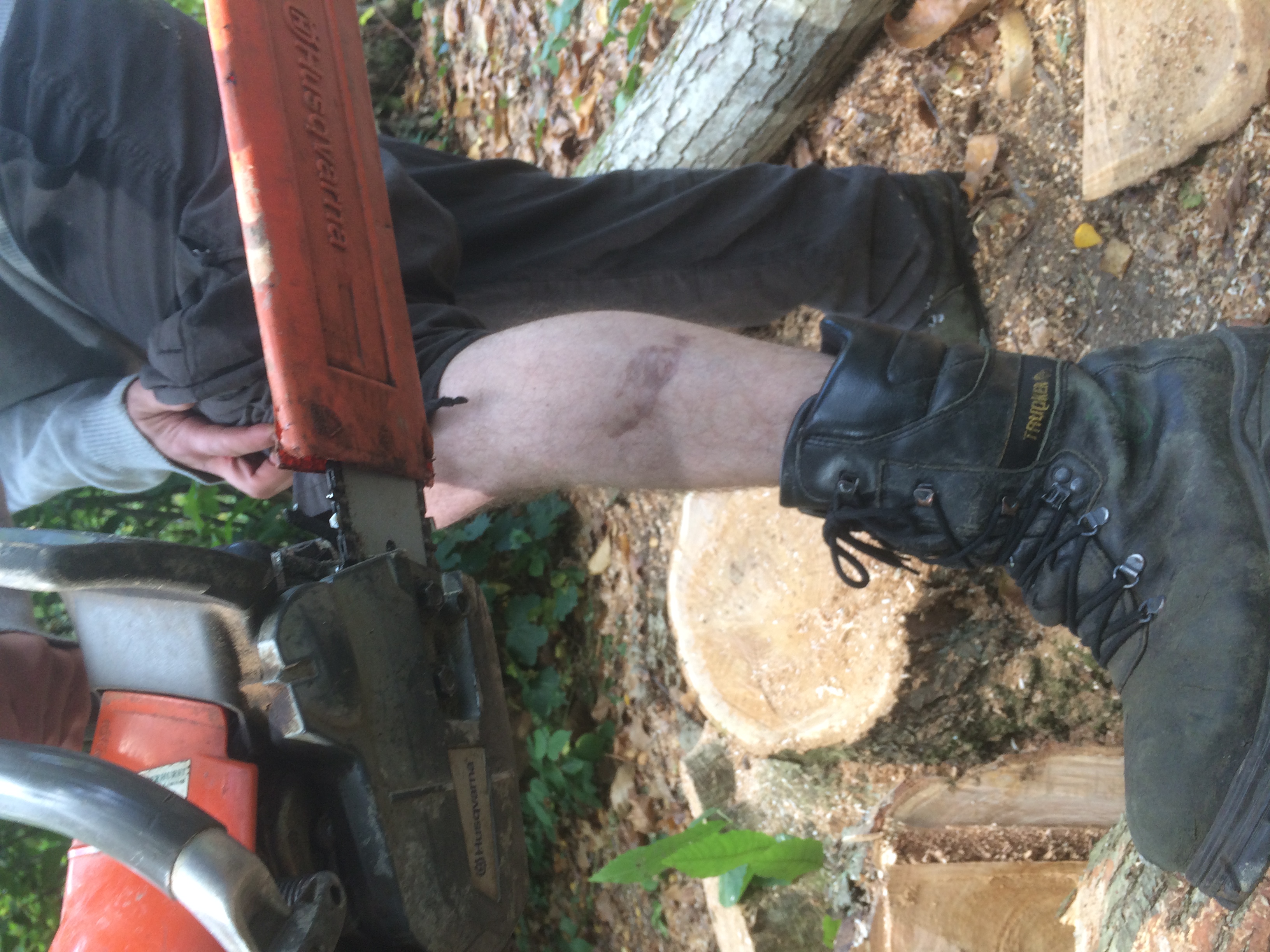 Preventing Chainsaw Accidents PPE, Training & Chain Brake Practice